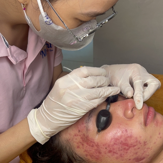Điều trị da